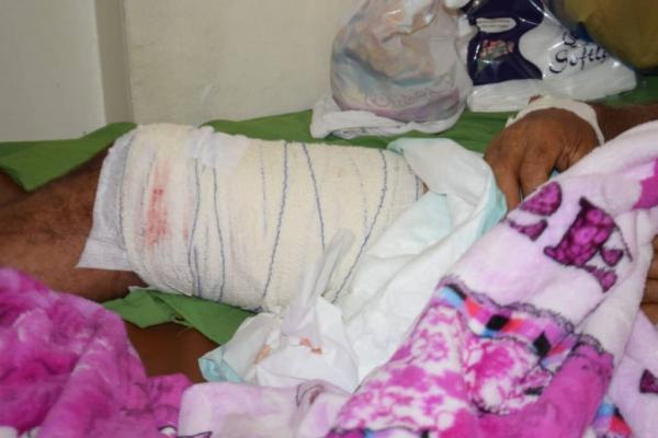 إصابة شاب برصاص قناص حوثي في حي كلابة بتعز