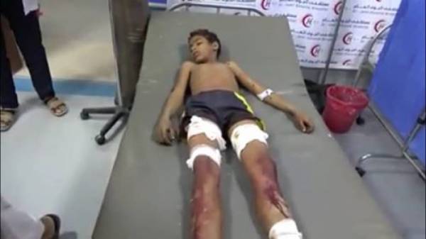 استشهاد طفل بقذيفة حوثية في قعطبة بالضالع - (الاسم والصورة)