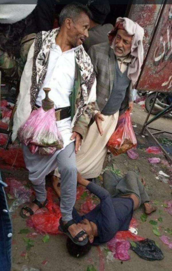 غضب شعبي من إقدام قيادي حوثي على دوس رأس مختل بقدمه في سوق بإب 