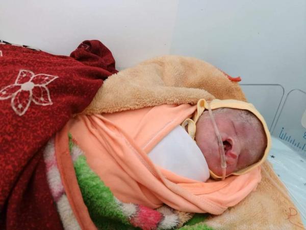 ولادة رضع بدون عينين وفم وأنف تثير حيرة الأطباء في مستشفى خليفة بالتربة