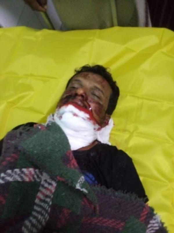 أنباء عن محاصرة مسلحي الجبولي بمعبق وتواصل القصف المدفعي على قرى المقاطرة  