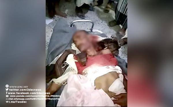 استشهاد مواطن في ضواحي حيس برصاص قناص حوثي – (الاسم والصورة)
