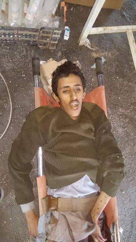 صور ووثائق - مقتل نجل قيادي حوثي بارز.. والفشل في سحب جثته من أرض المعركة بهذه الجبهة، رغم تضحية  المليشيات بـ 15 حوثي!