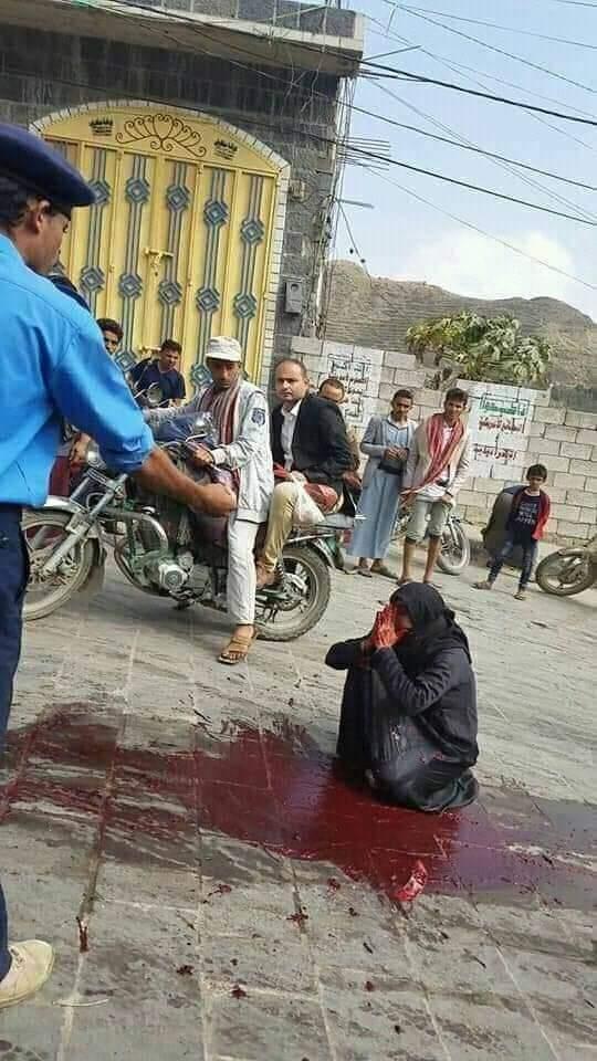 هزت المجتمع.. صورة من مسرح جريمة مروعة أرتكبها مرافق قيادي حوثي تثير استياء اليمنيين -(شاهد)