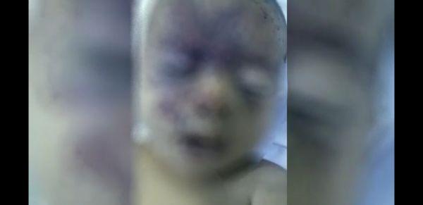 رضيع يفارق الحياة  متأثراً بجراحه جراء مجزرة الحوثي  بحق سكان "دريهمي الحديدة"