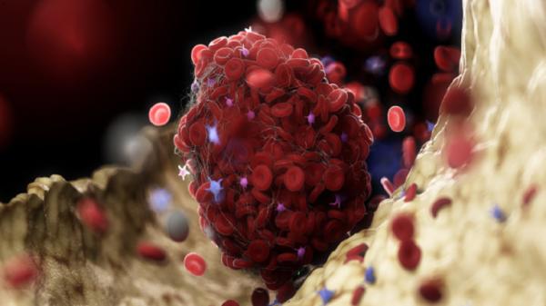 تمارين "سريعة" يمكنك القيام بها على مكتبك لمنع جلطات الدم!