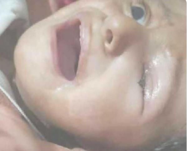 الطفلة شهد ضحية الأخطاء الطبية في مستشفى عبس بححة