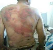 وكالة دولية تنقل شهادات مروعة وغير إنسانية لبشاعة تعذيب مليشيا الحوثي للمعتقلين في سجونها..! – (شاهد أسماؤهم وماذا قالوا)..؟