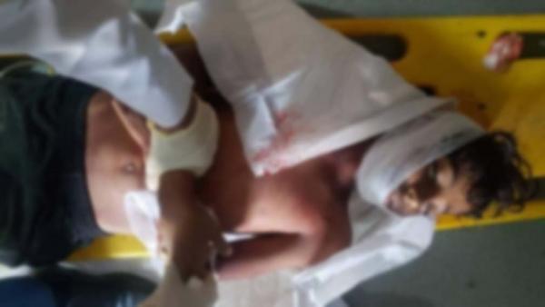 استشهاد وإصابة 4 أطفال بقصف طائرة حوثية على منازل في حجة