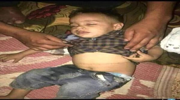 صحيفة عكاظ تتهم مليشيا الحوثي بخطف الأطفال وجرائم الاتجار بالبشر 