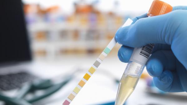 اكتشاف مذهل قد يمهد الطريق لاختبار يكشف مبكرا عن سرطان الكبد