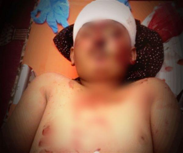 استشهاد طفل برصاص قناص حوثي في "زاهر البيضاء"