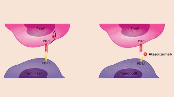 أول علاج مناعي لسرطان الأنسجة الرخوة عند الأطفال