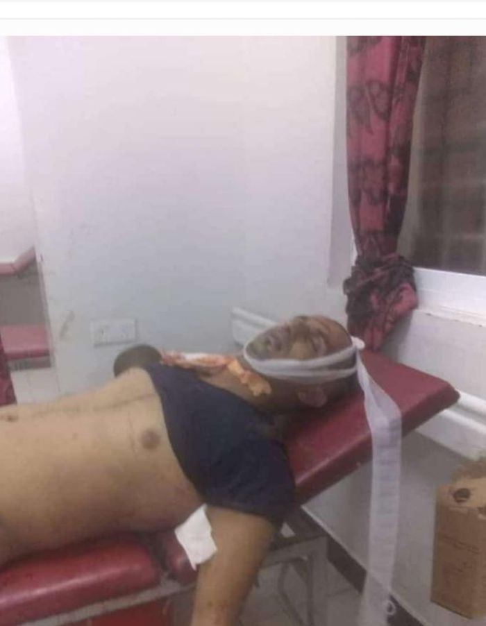 مسلح ينتمي للمحور يرتكب جريمة قتل في وسط مدينة تعز.