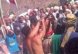 أحاديث شريفة تنسف ادعاءات شيعة الحوثي ليوم عاشوراء