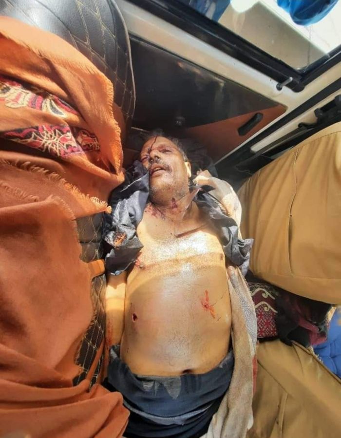 تربوي يقدم على قتل مواطن في احد اسواق القات بتعز