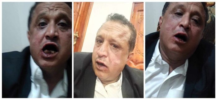 عصابة حوثية تعتدي على مدير إذاعة صوت اليمن بالضرب المبرح