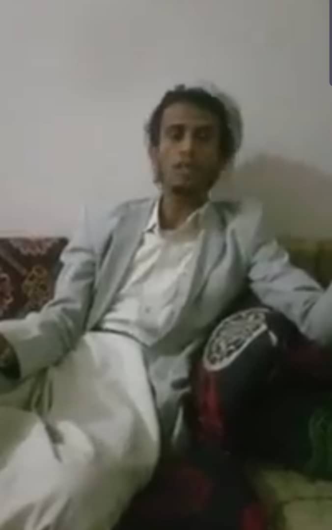 جريح حوثي يكشف المستور:  مشرفي العصابة نهبوا حقوقي وتخلوا عني بعد اصابتي