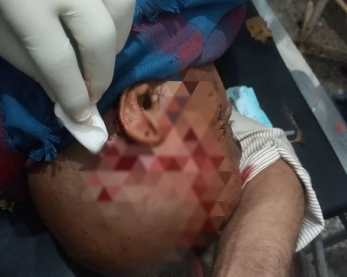 مشرف حوثي يعتدي على مُسن في ذمار لرفعه عَلم الجمهورية اليمنية