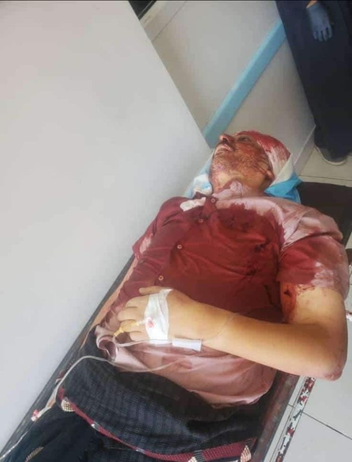 اغتيال صاحب محل صرافة بتعز ونجاة أركان اللواء 35 مدرع بالمواسط