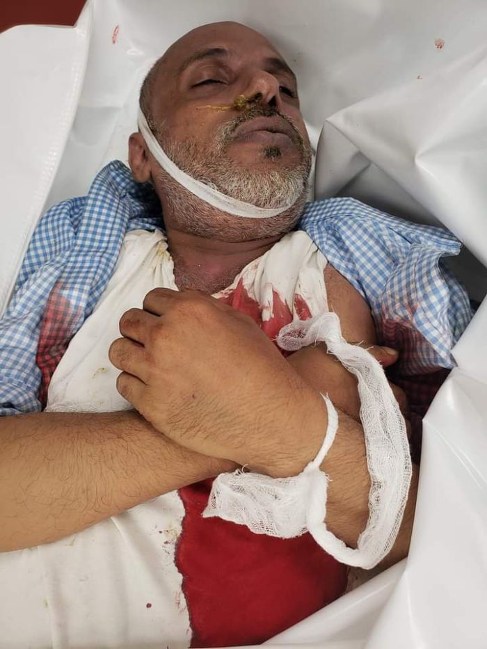 استشهاد مدني وإصابة طفل بقصف عصابة الحوثي لأحياء سكنية بتعز
