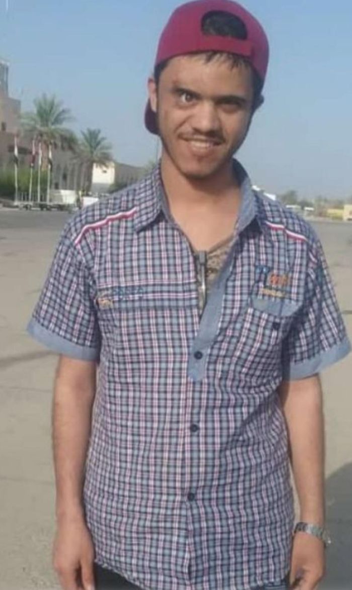 مصرع مختطَف تحت التعذيب الحوثي في السجن المركزي بصنعاء
