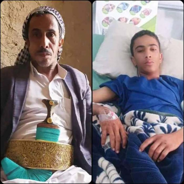 ارهابيو الحوثي يقتلون الشيخ الثمثمي وقبائل سفيان تتوعد بمحاسبة القتلة