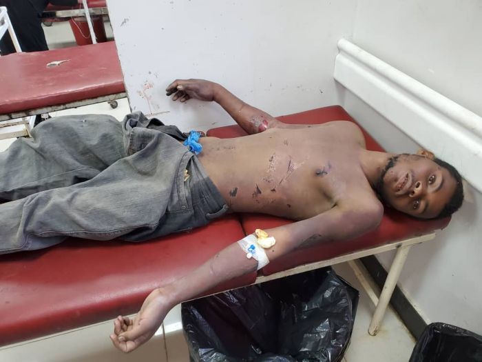 عذبته بطريقة وحشية ..  عصابة الحوثي ترمي مواطنًا مهمشًا في مناطق التماس غرب تعز