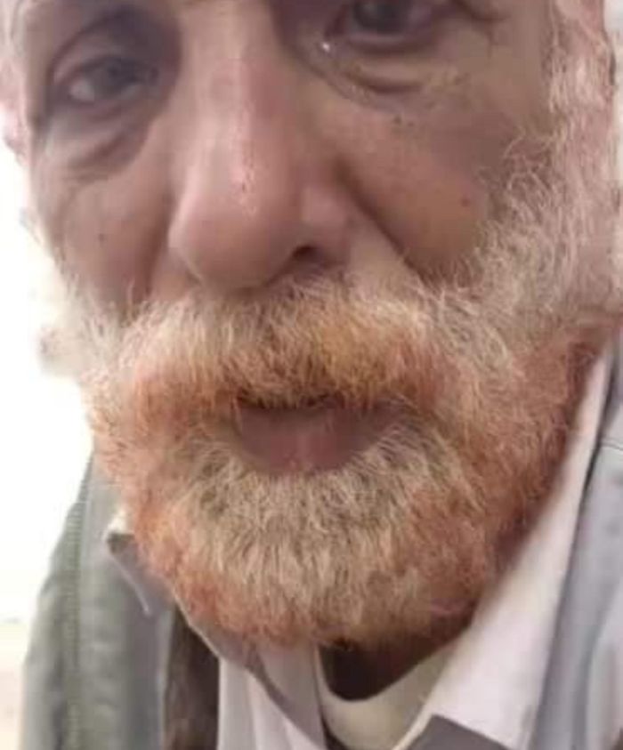 أب يتعرّض للضرب من ابنه للمرة الثانية بالمقاطرة