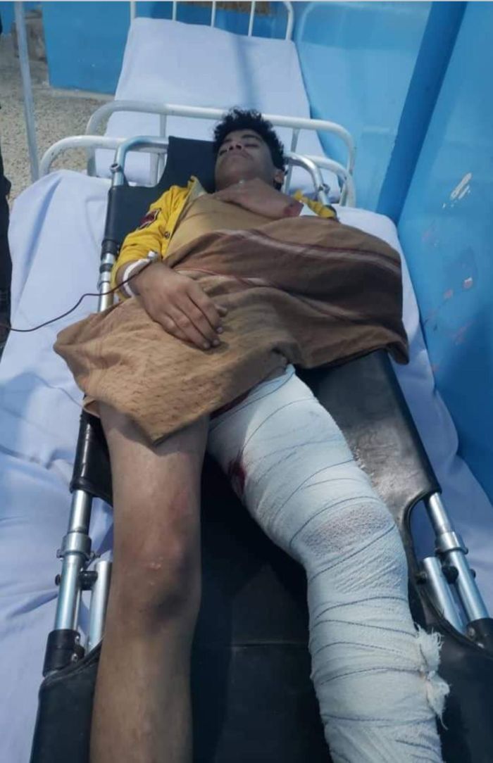 مسلحون يعتدون على مشروع كسارة المعافر وإصابة ثلاثة مواطنين بعيار ناري