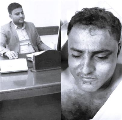 نتيجة التعذيب .. وفاة أحد موظفي مستشفى العلوم بصنعاء