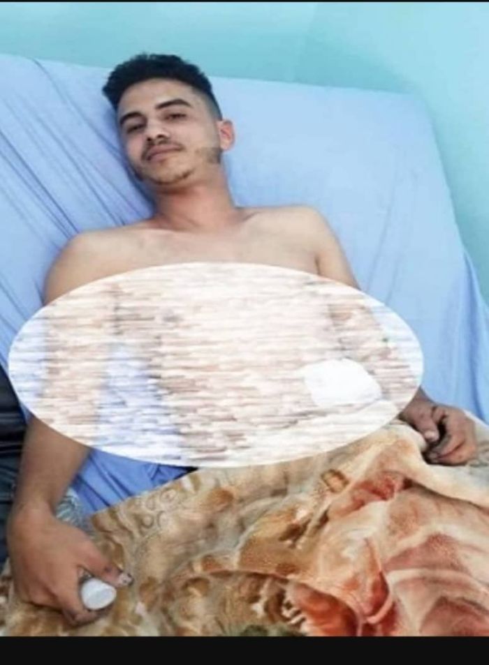 عصابة مسلحة تطلق النار على الأصبحي في إب  وتسرق أموال وجوالات المحل
