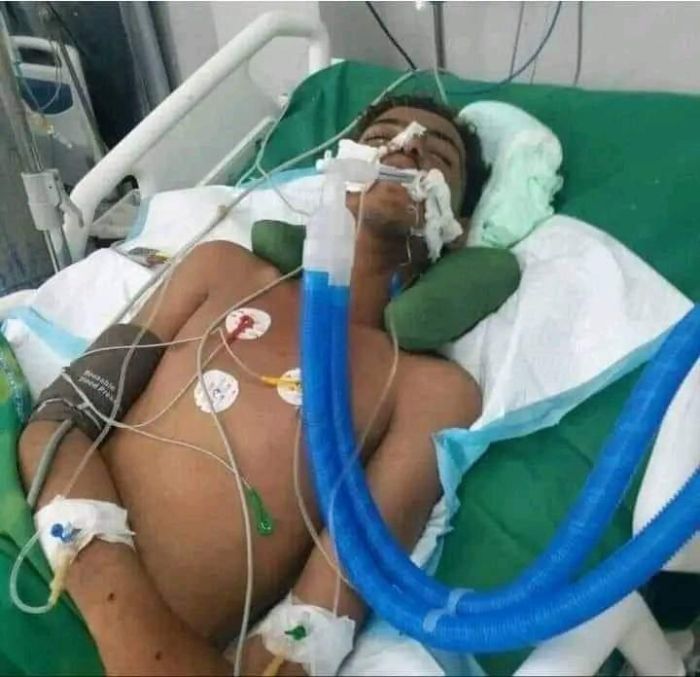 شاب يحاول الانتحار بسبب سرقة صديقه دراجته النارية والهروب إلى الحوبان