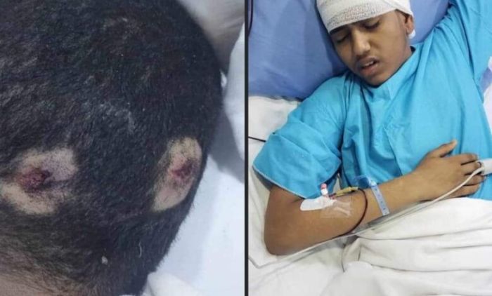 عصابة الحوثي الايرانية تصيب طفل في الحديدة