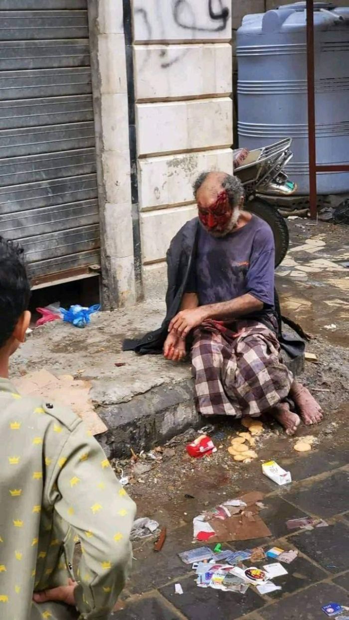 لجنة تحقيق في حادثة رفض مستشفى الثورة معالجة مختل عقليا ووفاته