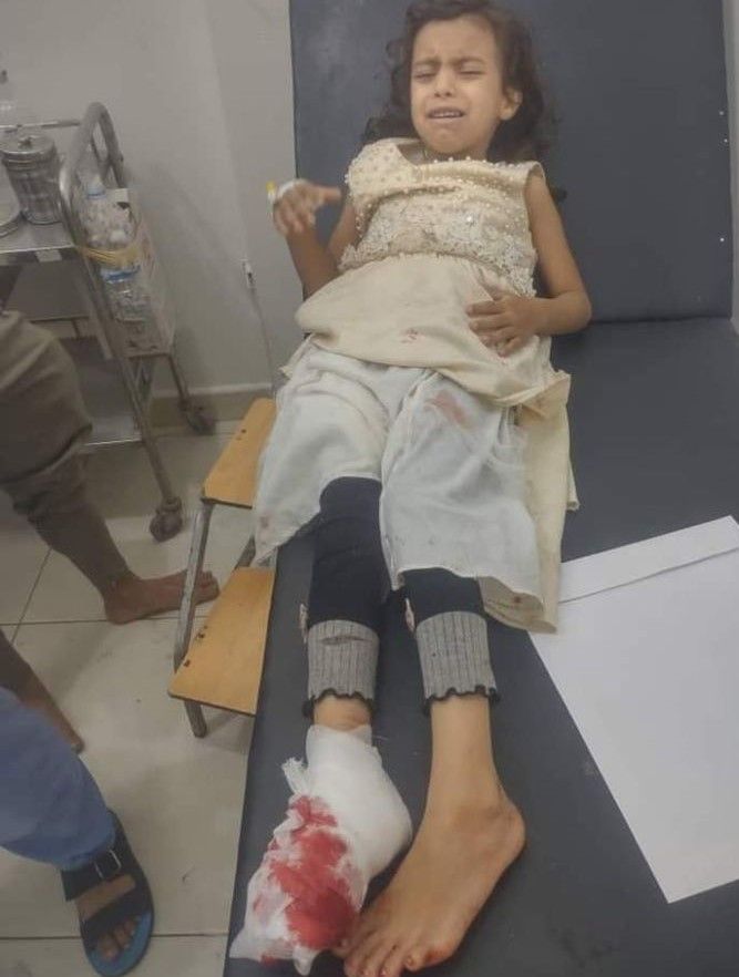  قناص حوثي يستهدف طفلة بحي الزهور بتعز