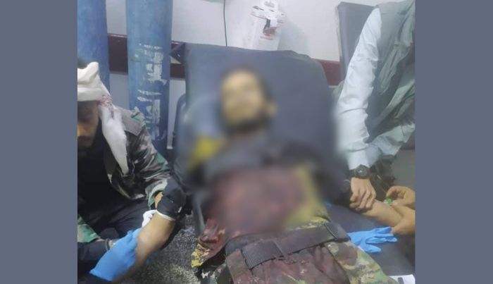 اغتيال جندي برصاص مجهولين في محافظة الضالع