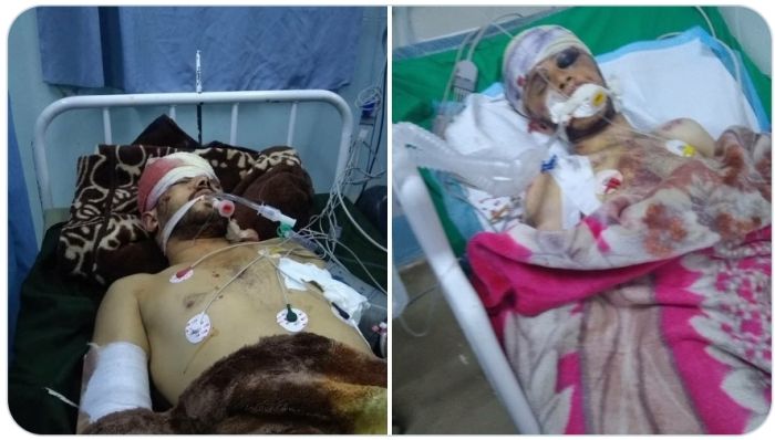 وفاة 5 مواطنين وإصابة 6 آخرين في حادث مروري في محافظة ذمار