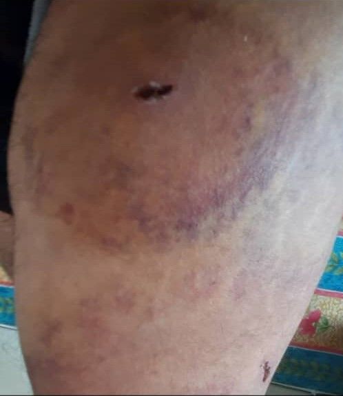جرائم ممنهجة تحت أقبية سجون عصابة الحوثي