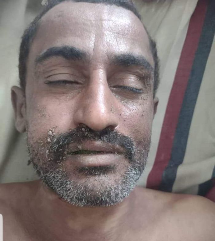 انتحار امرأة في قدس ورجل يشنق نفسه بالضباب