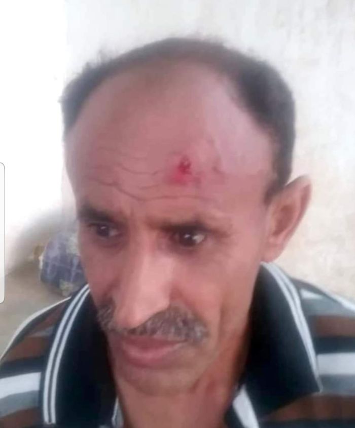 مدير أمن الحوثي  بالجراحي يعتدي على أحد أفراده ويشج رأسه