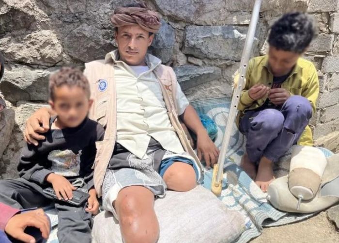 حصدت الأرواح ودمرت سبل العيش .. "رايتس" تكشف جرائم ألغام الحوثي بحق ابناء "الشقب" في تعز