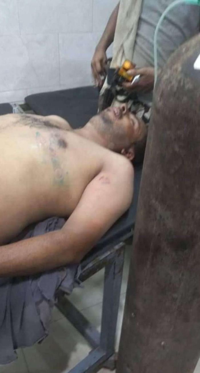 الربط العشوائي يعرض موظفي الطوارئ للخطر ..  الديزل ينفد من محطات الكهرباء والانطفاءات تعود إلى الواجهة في عدن
