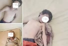 بسبب الأمطار والسيول الغزيرة .. وفاة أسرة جراء انهيار منزلها في المحويت .. وغرق ثلاثة أطفال  بالجوف