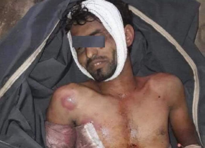  مقتل مختطف تحت التعذيب في سجون عصابة الحوثي شرق تعز