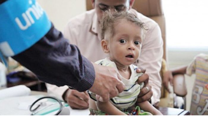  الصحة العالمية: 861 حالة وفاة بالكوليرا في اليمن خلال العام الجاري