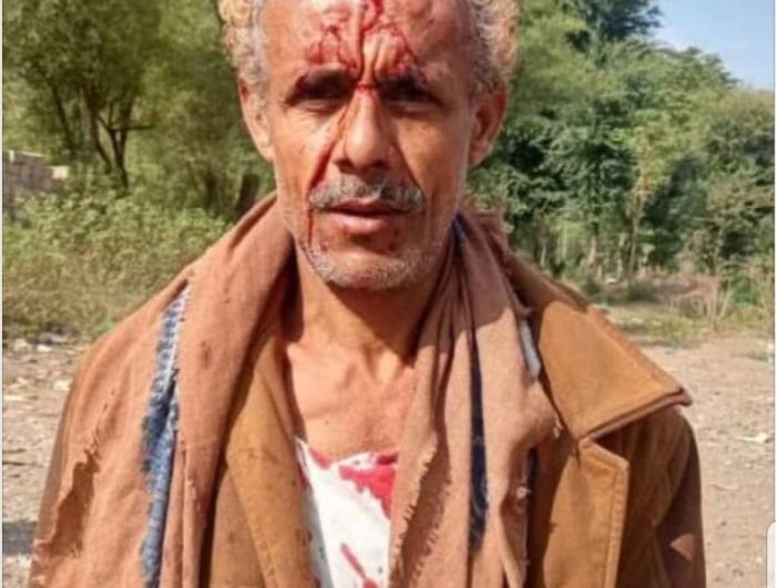 مسلح حوثي يعتدي على مواطن بشرعب السلام