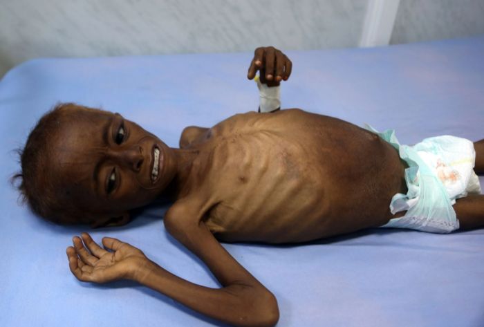  عقب تقرير جهاز الرقابة والمحاسبة .. استياءٌ واسعٌ بين اليمنيين من فساد الحكومة ونهبها موارد الدولة