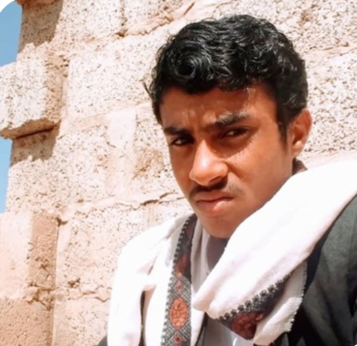  وفاة شاب تعذيبًا في سجن للحوثي بصنعاء