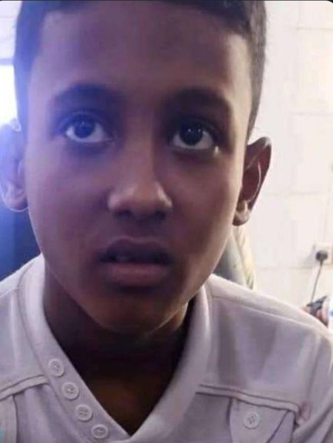  مدير مدرسة يكسر قدم طفل نازح وأولياء أمور يطالبون تربية أبين بمعاقبته